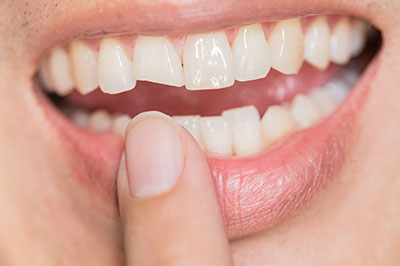 Albee Dental Care | Invisalign reg , Extractions and Emergency Treatment