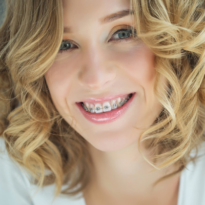 Albee Dental Care | Dental Cleanings, Invisalign reg  and Dental Sealants