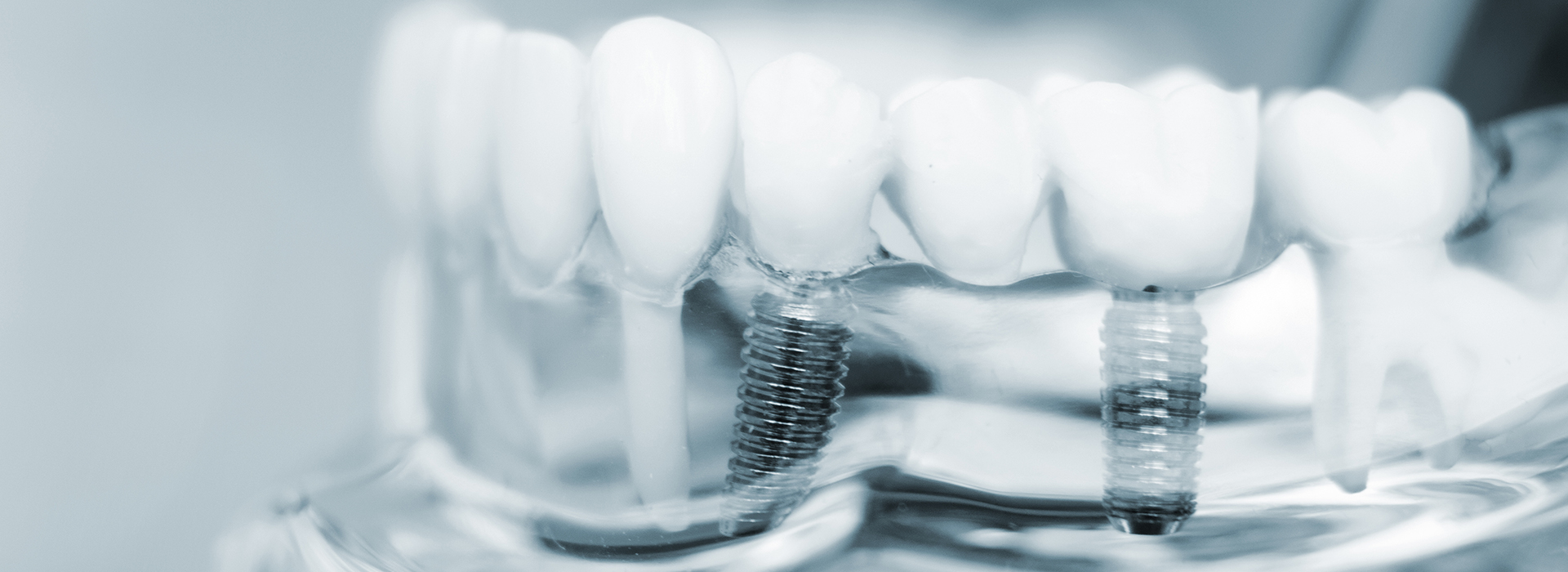 Albee Dental Care | Sleep Apnea, Dentures and Dental Cleanings