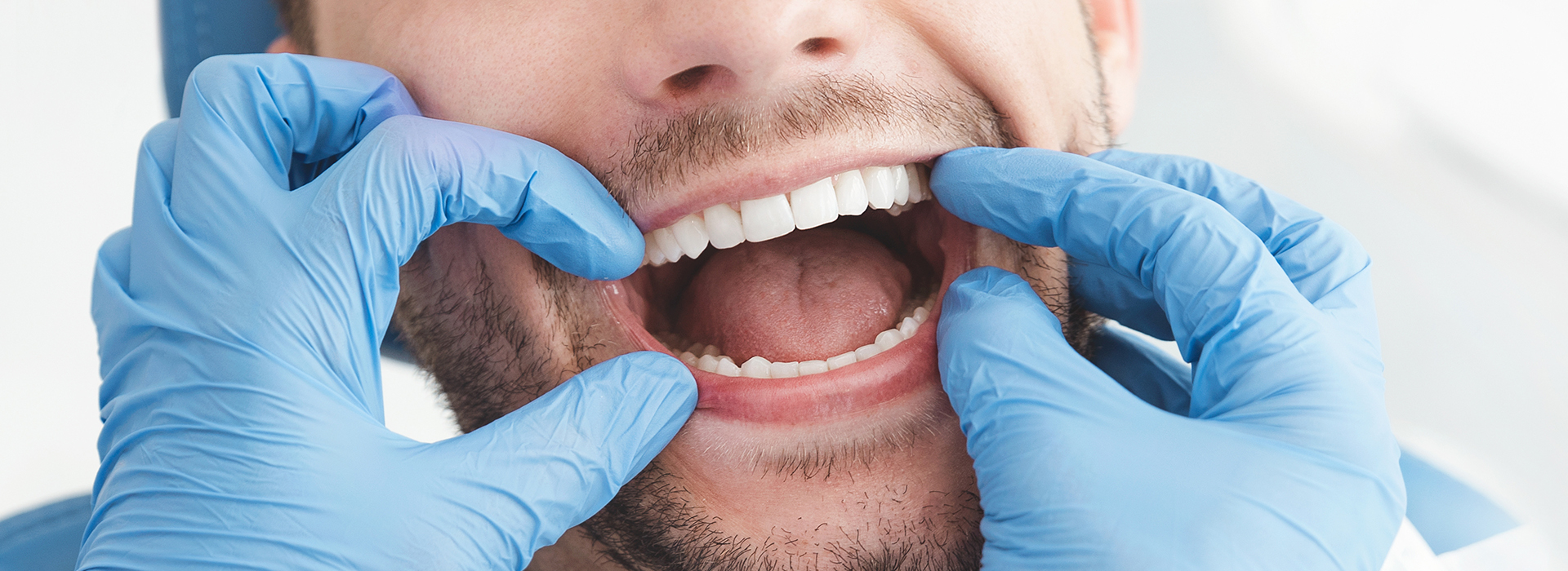 Albee Dental Care | Emergency Treatment, Oral Exams and Dental Sealants