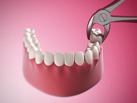 Albee Dental Care | Dental Sealants, Fluoride Treatment and Night Guards