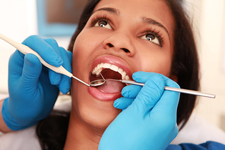 Albee Dental Care | Preventative Program, Root Canals and Fluoride Treatment